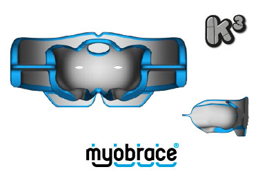Myobrace K3, Tamaño mediano, Color azul